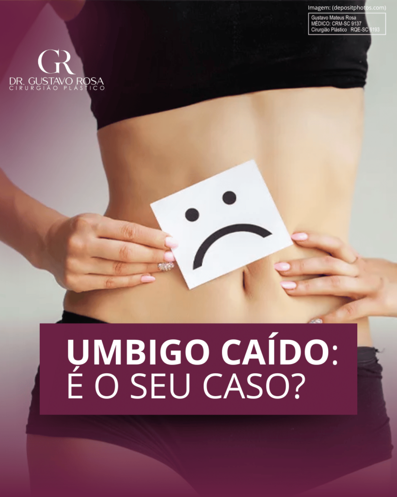 Inhalt com Comunicação | UMBIGO CAÍDO: É O SEU CASO?